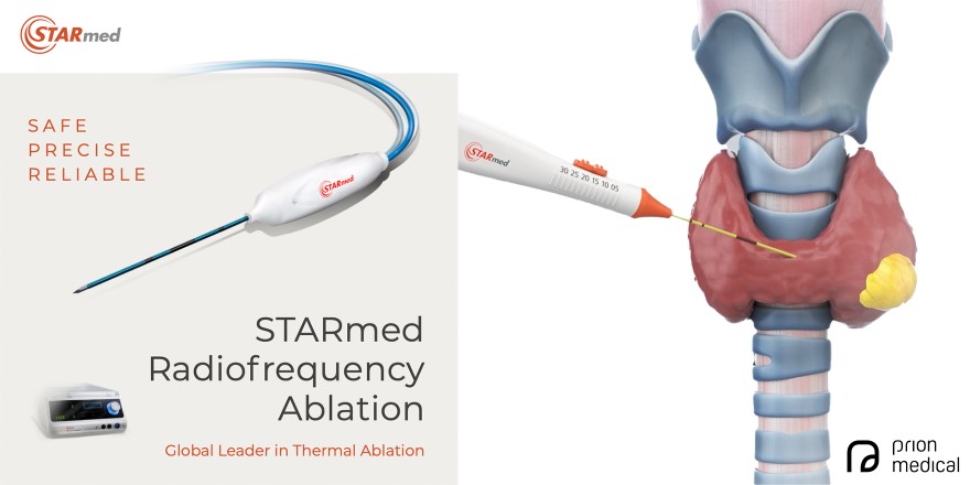 Radiofrequency Ablation for the Treatment of Benign Thyroid Nodules: 10-Year Experience